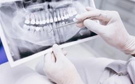 ممنوعیت اقدامات دندانپزشکی تحت بیهوشی در مطب ها