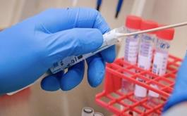 قیمت تست PCR کرونا در بخش دولتی و خصوصی اعلام شد