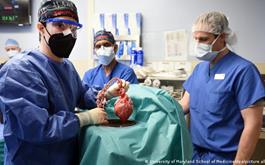 پیوند قلب اصلاح شده ژنتیکی حیوانی به انسان برای اولین بار