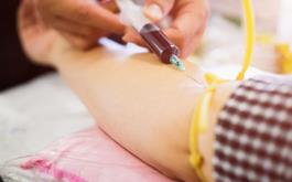 یک زن مبتلا به اچ‌آی‌وی با پیوند سلول‌های خون بند ناف درمان شد