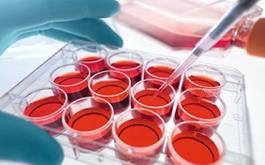 پذیره‌نویسی برای اهدای سلول‌های بنیادی خونساز از افراد ۱۸ تا ۳۵ سال