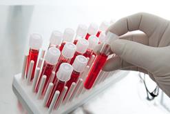 Research showing blood components from young can rejuvenate an old mou