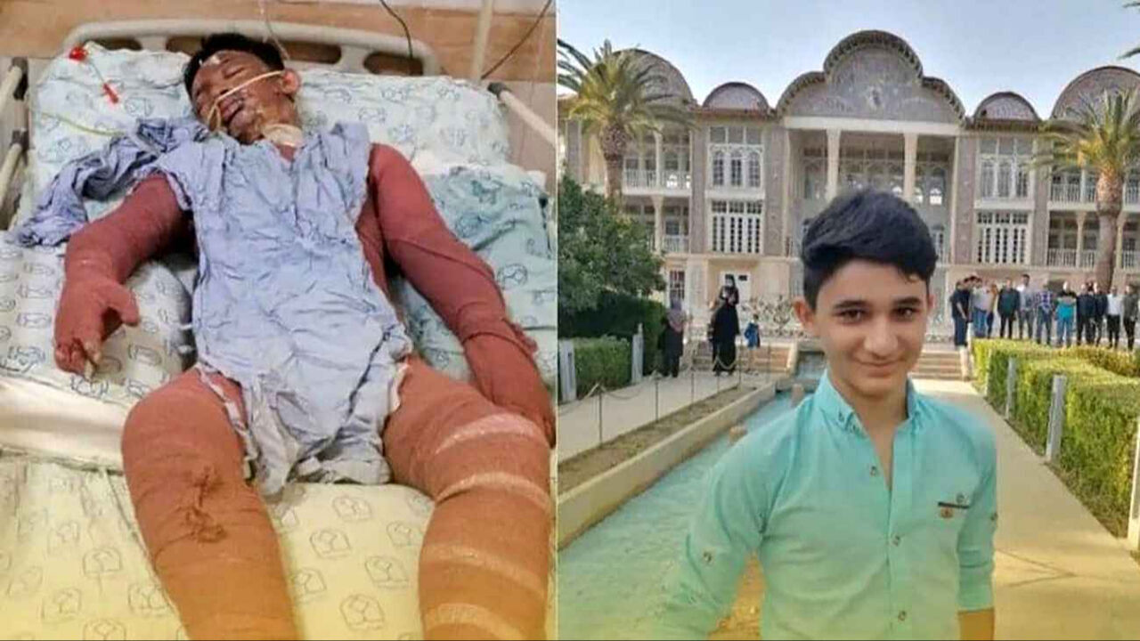 شرایط نوجوان فداکار ایذه‌ای در بیمارستان اصفهان پایدار است