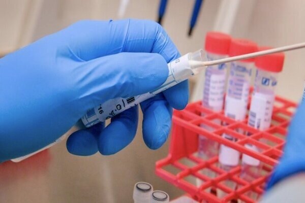 قیمت تست PCR کرونا در بخش دولتی و خصوصی اعلام شد