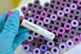 افزایش آزمایشگاه‌های تشخیص کرونا به ۲۲ آزمایشگاه در کشور تا هفته آینده